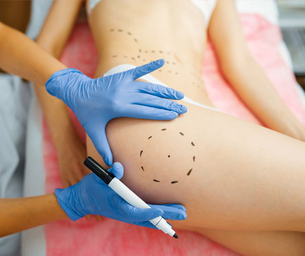 Cosmetician with marker puts dotted lines on body